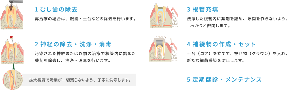 治療の流れ